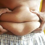 A person holding their stomach, highlighting folds and skin texture against a bright background.